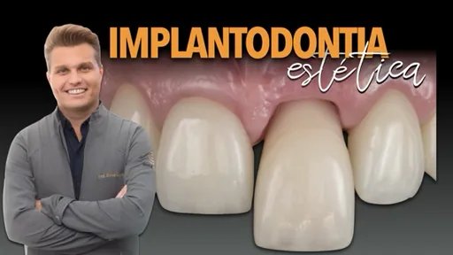 Implantodontia estética