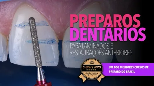 Preparos dentários